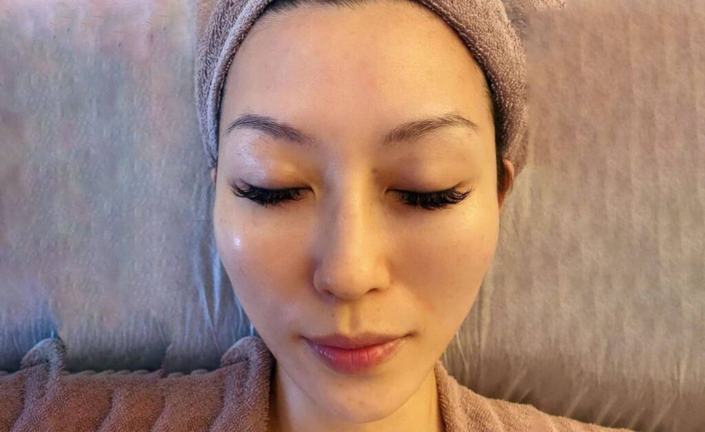 Guide to Non-Surgical Face Lifting: Exploring the Advantages 4 face lifting