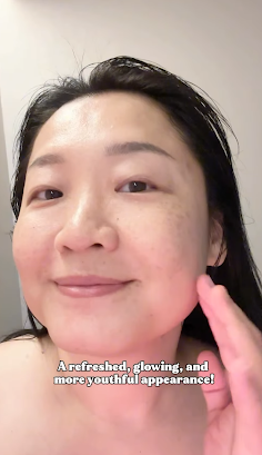 How Vinca Got Her Glow Back with the Meridian Bojin Facial at TaraBliss 5 vinca 5